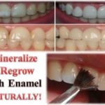 How To Restore Tooth Enamel Naturally - My Daily Magazine - Art, Design ...