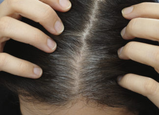 All You Need to Know about Having Grey Hair in Your Twenties