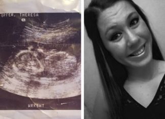 From Kidney Stones to Labor: This Woman Didn’t Know She Was Pregnant Until 30 Minutes Before She Gave Birth