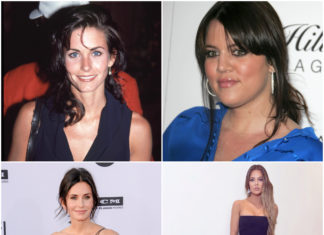 Plastic Fantastic: 40+ Celebs Who Admit Going Under The Knife